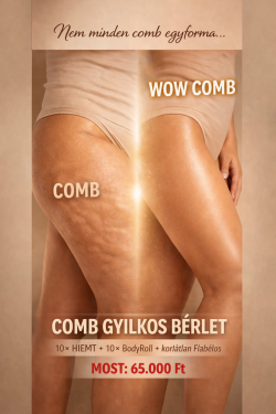 Combgyilkos bérlet – Feszesebb, simább, formáltabb combok